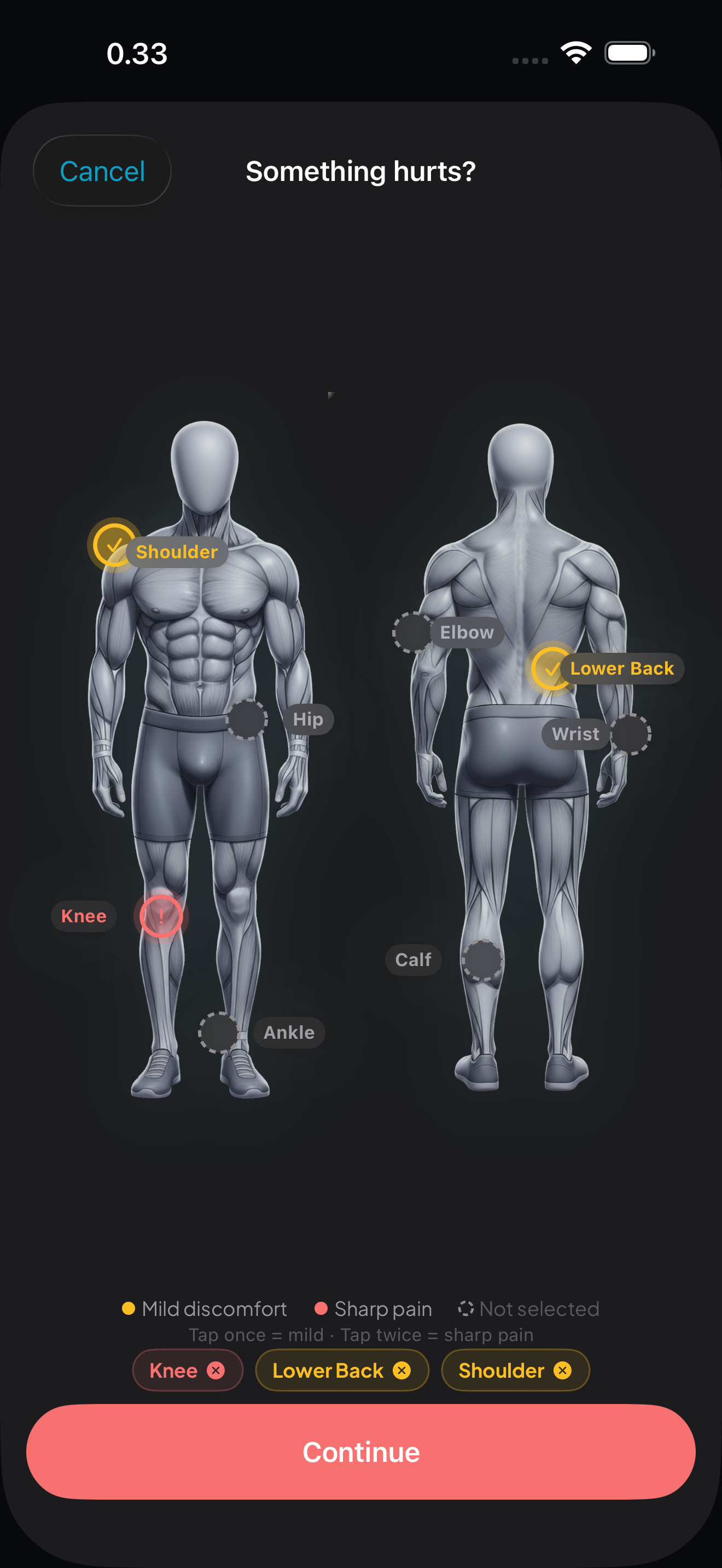 Injury report body map with tappable pain points and severity levels