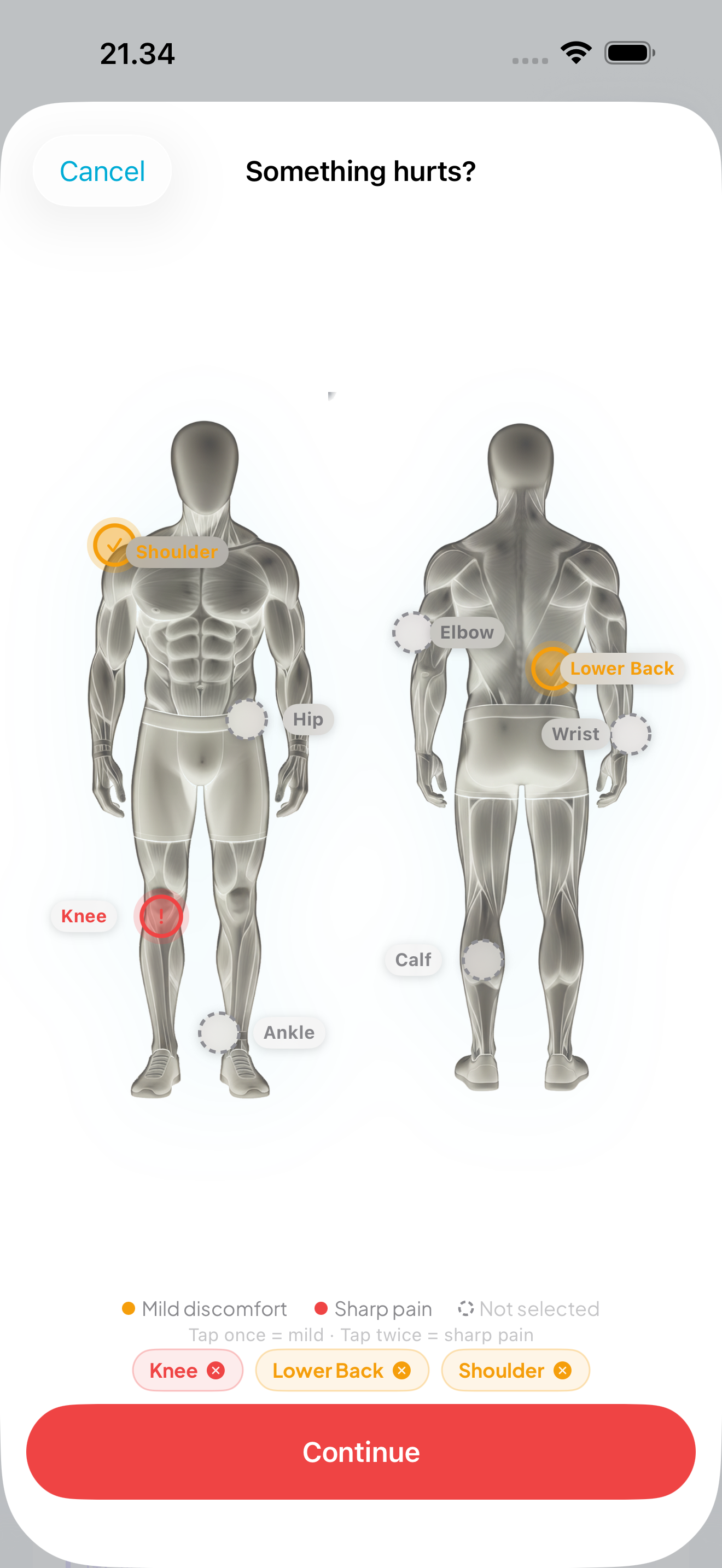 Injury report body map with tappable pain points and severity levels